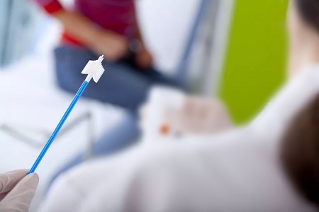 Kemajuan dalam skrining kanker serviks: Peran tes HPV pengumpulan diri sendiri