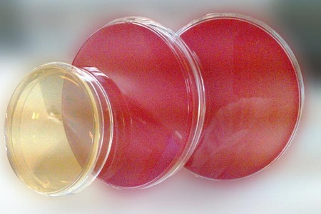 Salmonella Shigella Agar (SS): Media penting untuk isolasi patogen