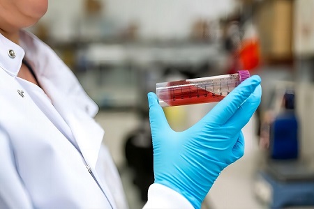 Kit Transportasi Virus (Non-Inaktivasi)-Pengumpulan Sampel Virus Aman