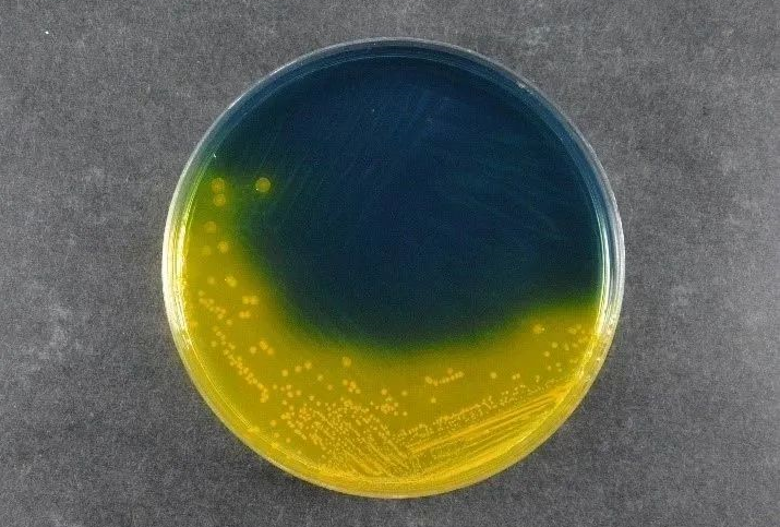 Memastikan Keamanan Pangan: Babio's Salmonella Shigella Agar (SS) mendukung standar deteksi patogen global