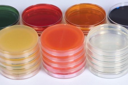 Triple Sugar Iron Agar (TSI): Diferensiasi akurat basil enterik dengan Babio