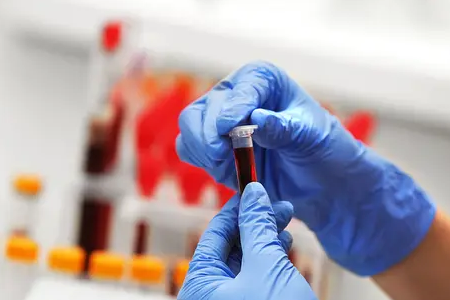 Deteksi Cepat Malaria: Alat Tes Antigen Ganda BABIO Memberdayakan Kesehatan Global